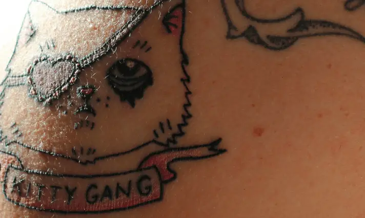 Why Is My Tattoo Raised And Itchy After It Has Healed Product Rankers